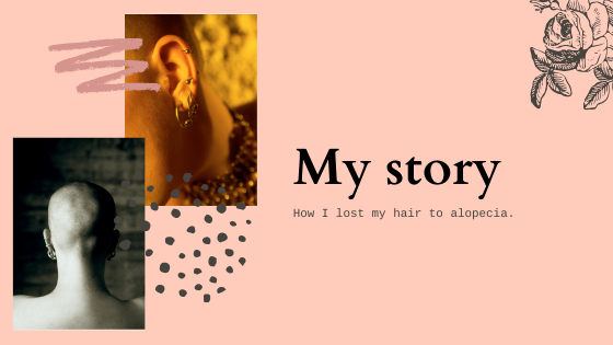 My story - How I lost my hair to alopecia ...